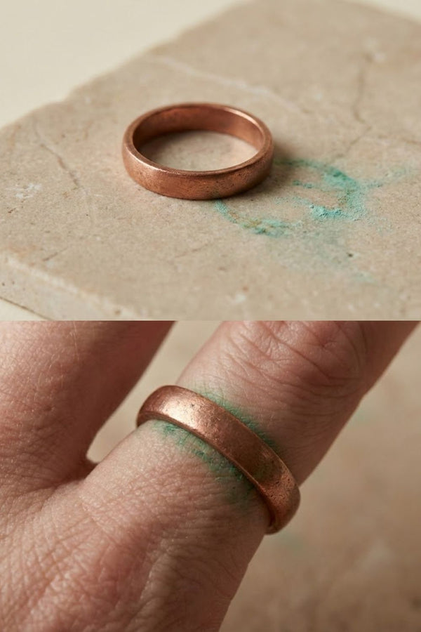 Why Does Jewelry Turn Skin Green - Causes & How to Prevent It